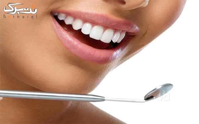 خدمات زیبایی دندان در مطب دندانپزشکی دکتر آرش دانک