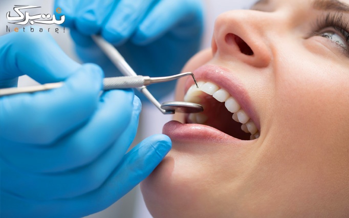 ترمیم کامپوزیت یک سطحی در مرکز دندانپزشکی سپیدار