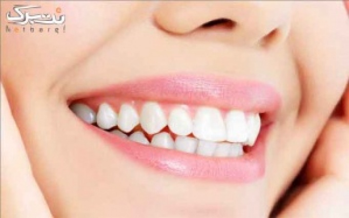 خدمات دندانپزشکی در دندانپزشکی دکتر فخر طباطبایی