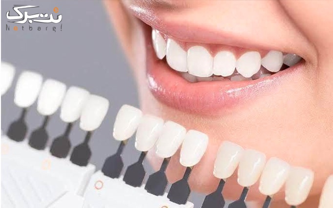 ترمیم همرنگ و غیرهمرنگ دندان درمطب دندانپزشکی قلهک