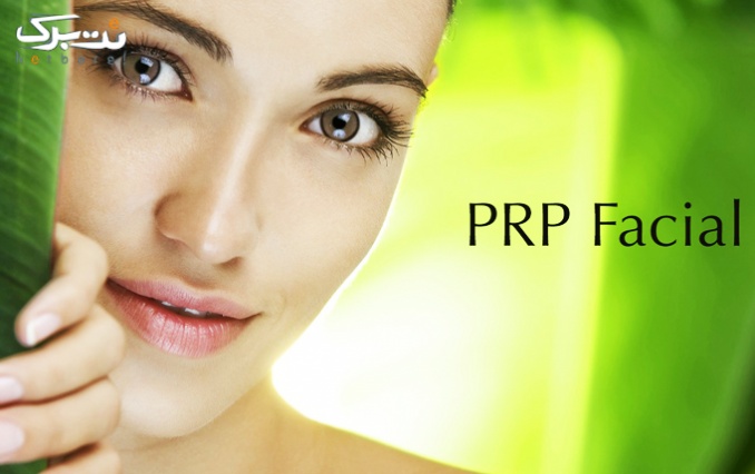 PRP مو یا صورت در کلینیک به رویان