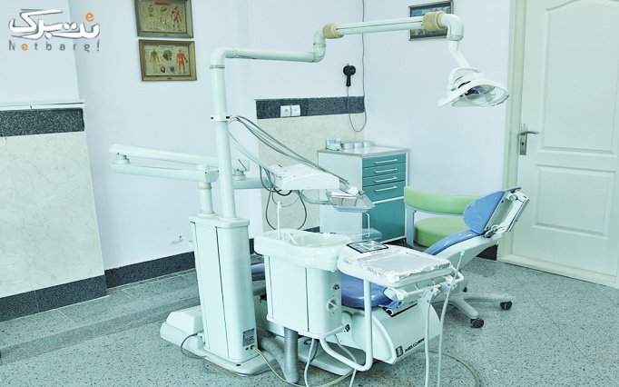 جرمگیری دندان ها در دندانپزشکی انصار المهدی
