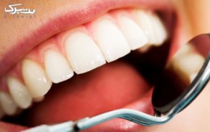 جرمگیری دندان در کلینیک بهار تندرستی