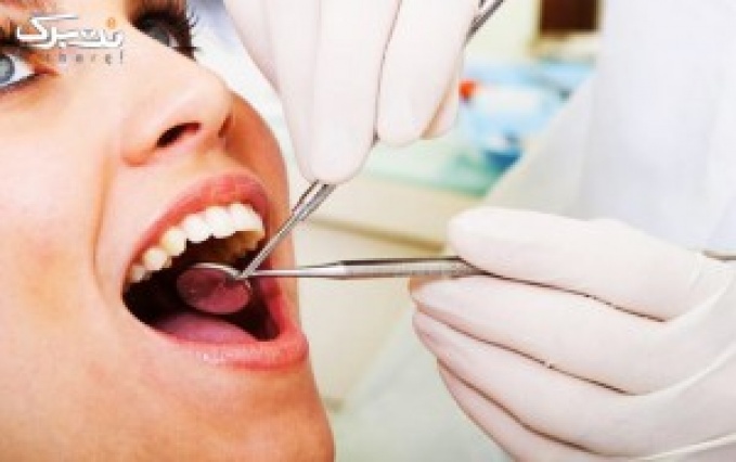پکیج 3: کاشت نگین دندان با دکتر صادقی