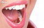 معاینه رایگان با نصب نگین های رنگی دندان در مطب دکتر دادرس