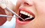 پر کردن دندان با کامپوزیت هر واحد در مطب دکتر عبدی
