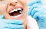 ترمیم دندان با آمالگام توسط دکتر زمانی