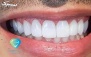 خدمات دندانپزشکی در دندانپزشکی دیاموند