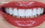 خدمات دندانپزشکی در دندانپزشکی دیاموند