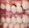 خدمات دندانپزشکی در دندانپزشکی سارا گل