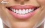 انواع خدمات دندانپزشکی در دندانپزشکی دکتر سعیدی