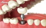 خدمات تخصصی دندانپزشکی در دندانپزشکی سینا
