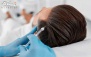 مزوتراپی موی سر در مرکز درمانی میکال