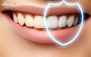 جرمگیری در دندانپزشکی هومينا پلاس