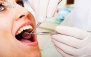 جرمگیری و بروساژ در کلینیک دندانپزشکی تبسم 