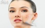 فیشال vip در پاکسازی تخصصی پوست ایسان