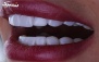 خدمات دندانپزشکی در کلینیک تخصصی و فوق تخصصی لبخند