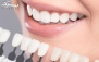 خدمات دندانپزشکی در دندانپزشكی دكتر يسرا صفيعی
