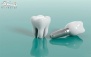 ترمیم دندان در مطب دندانپزشکی دکتر فرجاد واسعی