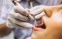 خدمات زیبایی دندان در دندانپزشکی دکتر گودرزی