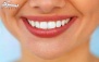 خدمات زیبایی دندان در مطب دندانپزشکی دکتر آرش دانک