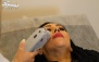 تزریق 1 سی‌سی فیلر صورت در کلینیک زیبایی نگار