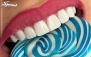 کشیدن دندان خلفی کلینیک دکتر مانا توسلی خواه