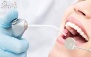 خدمات تخصصی دندانپزشکی در دندانپزشکی الماس