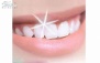 پکیج2: کاشت نگین دندان در کلینیک لوبا