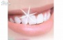 کاشت نگین دندان در دندانپزشکی گلبرگ 