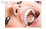 پیش پرداخت ارتودنسی توسط متخصص در مطب دندانپزشکی دکتر عشاق 